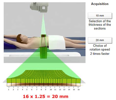 Ct Image Acquisition Medical Professionals