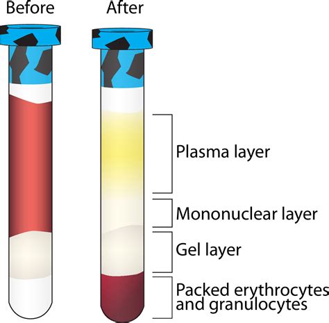 Rapid Fractionation And Isolation Of Whole Blood Components In Samples