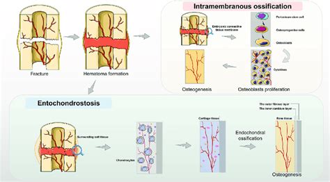 Two Main Types Of Periosteum Osteogenesis Intramembranous Ossification