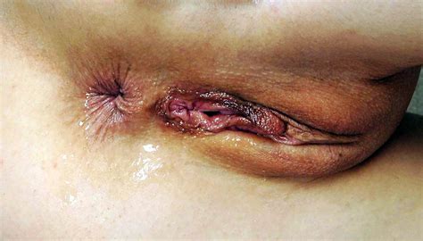 Nackte Muschi Nahaufnahme Erotische Bilder Von Nackten Jungen M Dchen Vagina