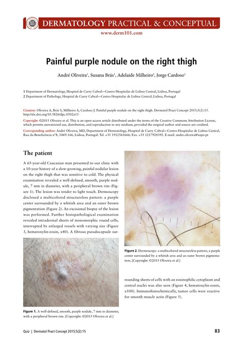 Pdf Painful Purple Nodule On The Right Thigh Answer