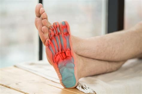 Joint Diseases Hallux Valgus Plantar Fasciitis Man S Leg Hurts Pain