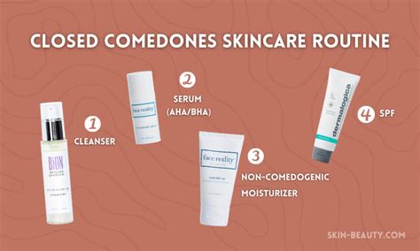 Comedonal Acne How To Get Rid Of Closed Comedones Skin Beauty