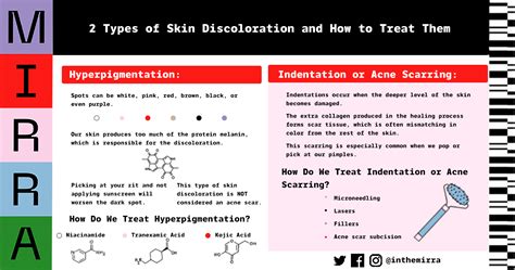 2 Types Of Skin Discoloration And How To Treat Them Mirraskincare