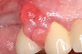 The importance of periodontal treatment in post–COVID-19 dentistry ...