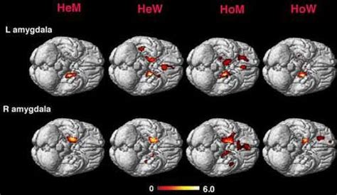 Gay Brains Structured Like Those Of The Opposite Sex New Scientist