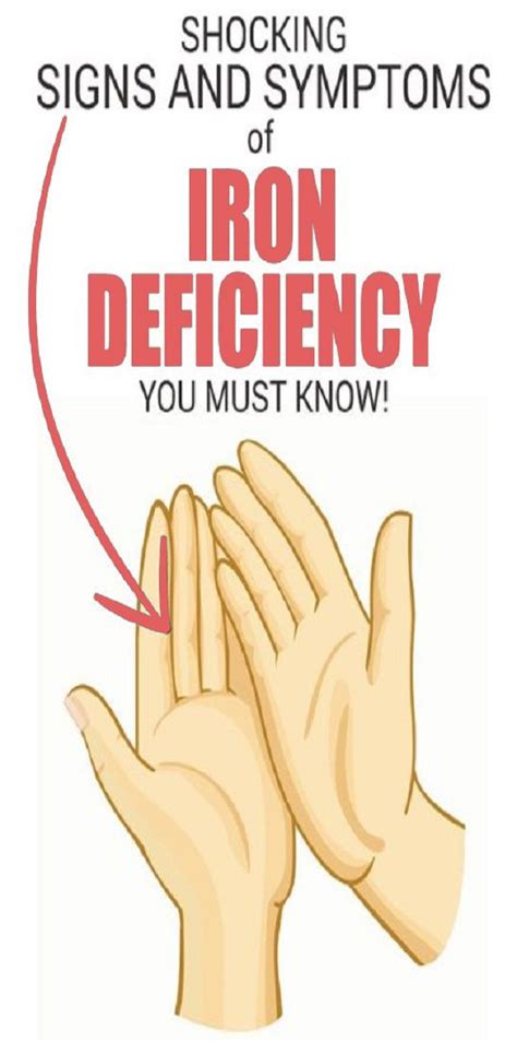 Signs Of Iron Deficiency You Should Never Ignore Health Facts Body