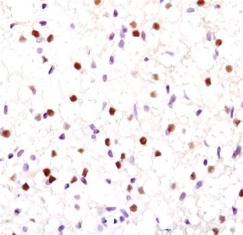Ppar Gamma Antibody Ma5 14889