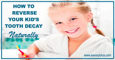 About 1 in 10 children experience tooth decay before they are two years old. How to Reverse Your Kid's Tooth Decay Naturally - Savory Lotus