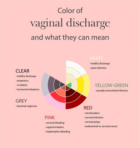 Colour Coded Guide To Vaginal Discharge