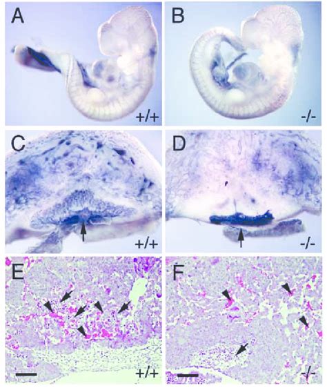 Angiogenesis In Embryo Proper And Placenta At 1075 Dpc Ab The