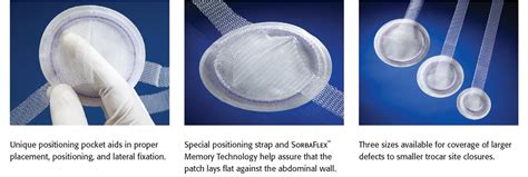 Ventralex™ Hernia Patch Clinically Proven For Hernia Repair Bd