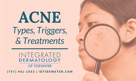 Acne Types Triggers And Treatments Integrated Dermatology Of Tidewater