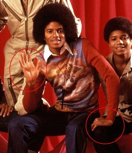 Michael Jackson Photo The Vitiligo Proof Michael Jackson Skin