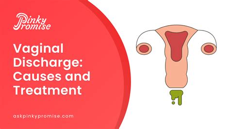 What Causes Vaginal Discharge Treatment For Vaginal Discharge My XXX Hot Girl