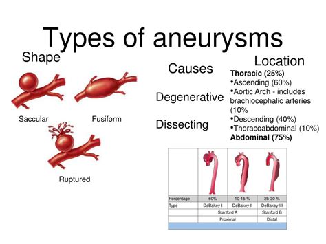 Ppt Aortic Aneurysms Powerpoint Presentation Free Download Id608703