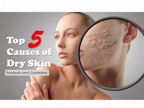 Do You Have Dry Skin Top Five Causes Of Dry Skin Cosmetic Medicine MD