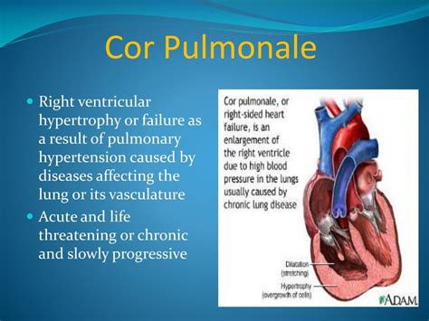 Ppt Respiratory Failure And Cor Pulmonale Powerpoint Presentation Id