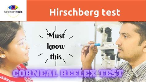 Hirschberg Test II Corneal Light Reflex Test YouTube