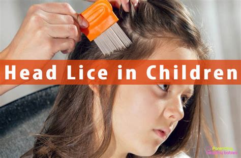 Head Lice In Children Symptoms Causes Diagnosis And Treatments