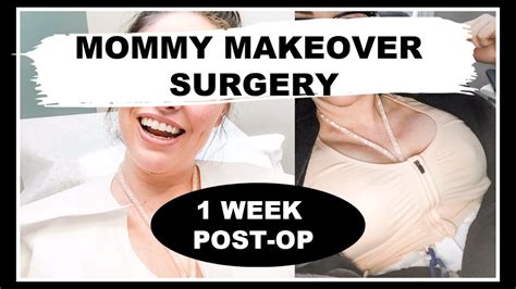 Mommy Makeover Surgery Experience 1 Week Post Op Tummy Tuck Recovery Sarah S Wifestyle