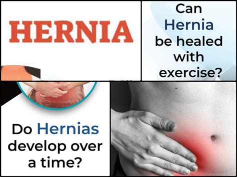 Hernia Symptoms Causes Types Risk Treatment