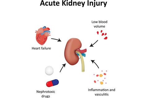 Acute Kidney Injury In El Paso Tx