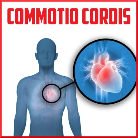 Commotio Cordis In Athletes Sports Medicine Review