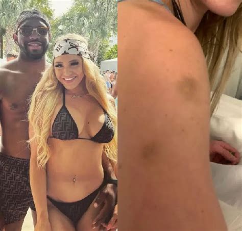 New Photos Show OnlyFans Star Courtney Clenney Covered In Bruises After