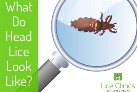 What Do Lice Look Like You May Need Professional Lice