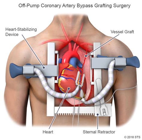 Heartvascular