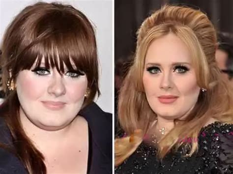 Adele Before And After Plastic Surgery Celebrity Plastic Surgery Online
