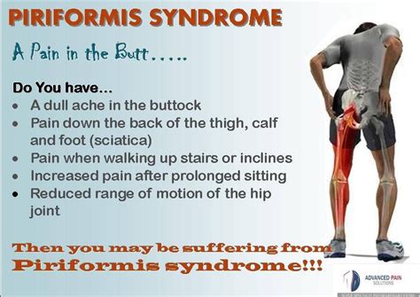 Piriformis Syndrome A Pain In The Butt Piriformis Stretch Piriformis Muscle Sciatica