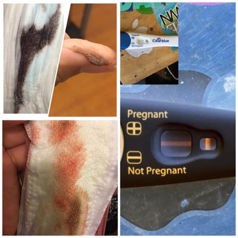 Is This Implantation Bleeding Or Just A Normal Period Vrogue Co