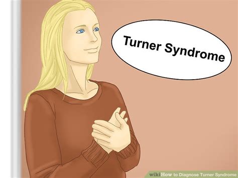 how to diagnose turner syndrome 11 steps with pictures