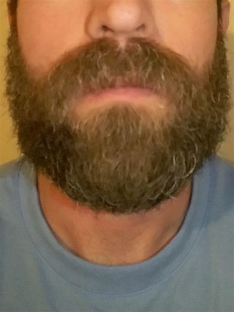 2 Months Beards