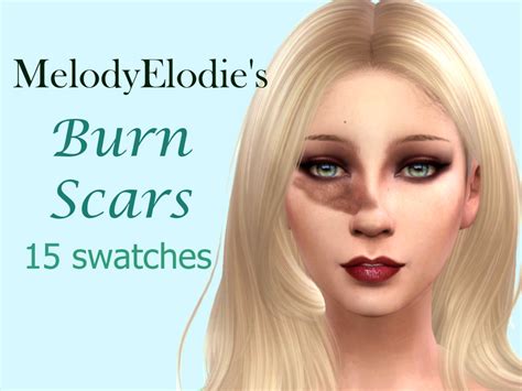 Melodyelodies Burn Scars