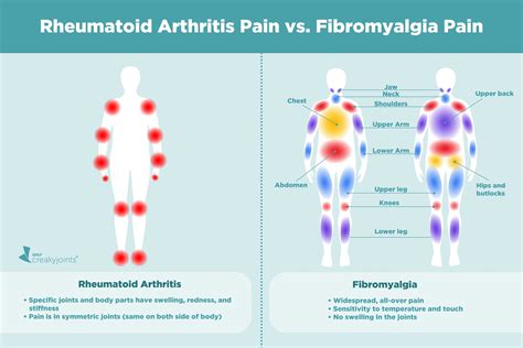 Causes Of Rheumatoid Arthritis Pain Aside From Inflammation