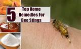 Bee Sting Home Remedies For Swelling Images
