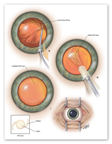 Precision Medical Media — Portfolio