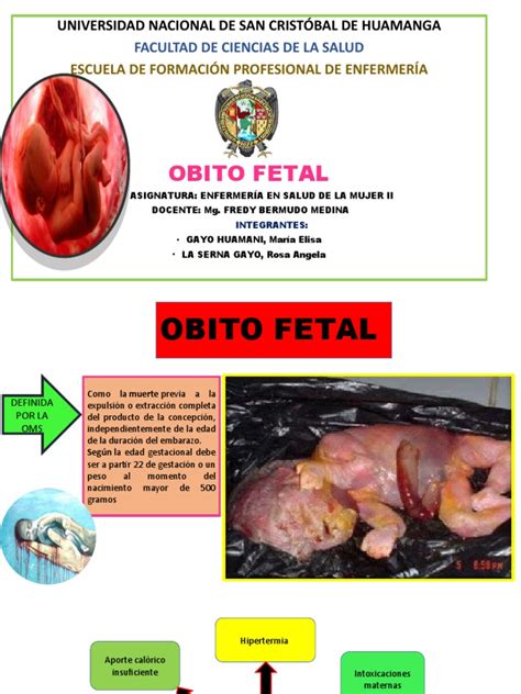 Exposicion Grupo 11 Obito Fetal Pdf El Embarazo Placenta
