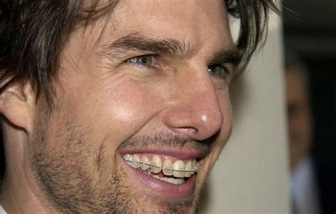Tom Cruise Teeth Before And After Celebrity Teeth Before And After Dental Blog Park