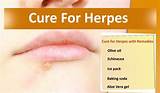 Pictures of Best Genital Herpes Medication