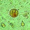 Immature Entamoeba histolytica cyst (mature cysts have 4 nuclei ...