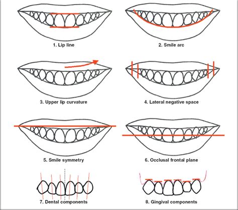 Impact Of Eight Components Of Smile On Orthodontics