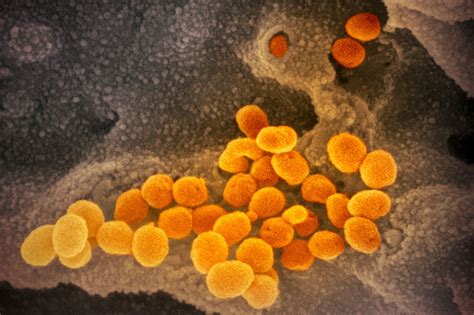 Coronavirus Could Be Transmitted Through Feces Of Infected Patients Study Says