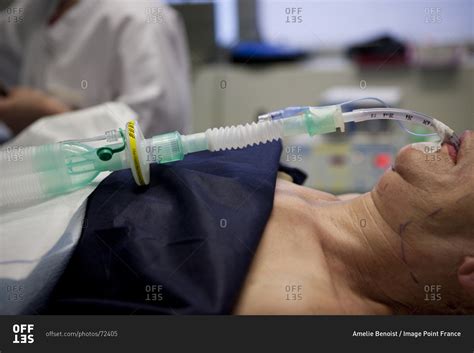Close Up Of Intubated Patient Undergoing Asthetic Surgery Stock Photo