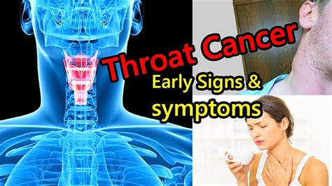 White Spots On Throat Symptoms
