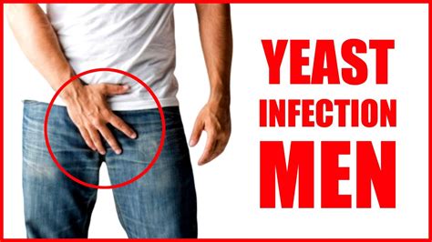 Yeast Infection In Men Male Yeast Infection Symptoms Thrush Fungal