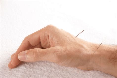 Ferntree Gully Balance Acupuncture Immediate Pain Reduction